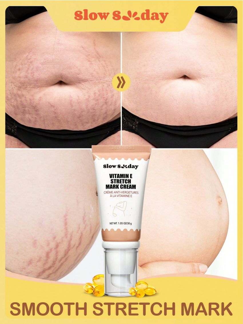 SlowSunday Vitamin E Stretch Mark Cream